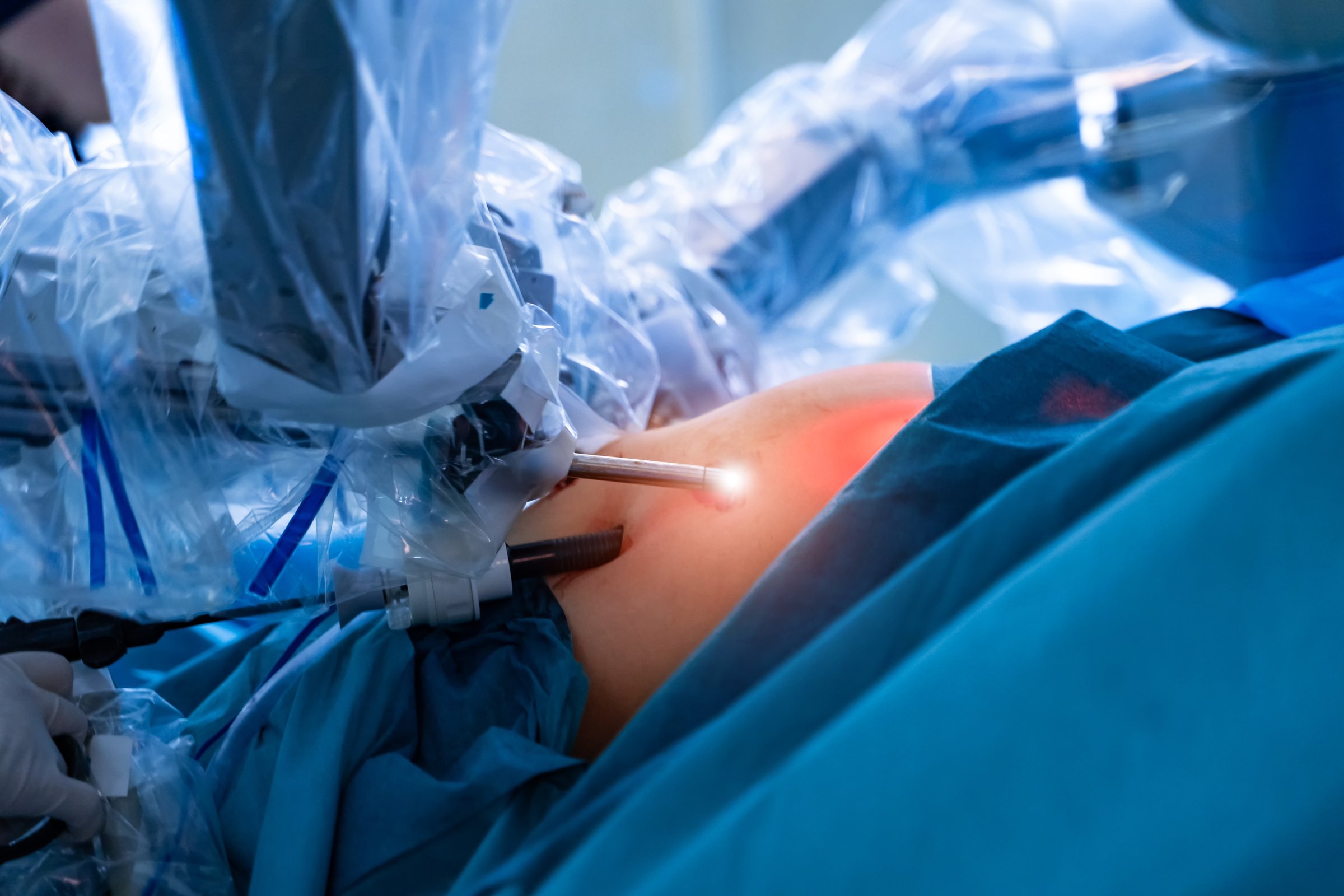 Surgical room in hospital with robotic technology equipment, machine arm surgeon in futuristic operation room